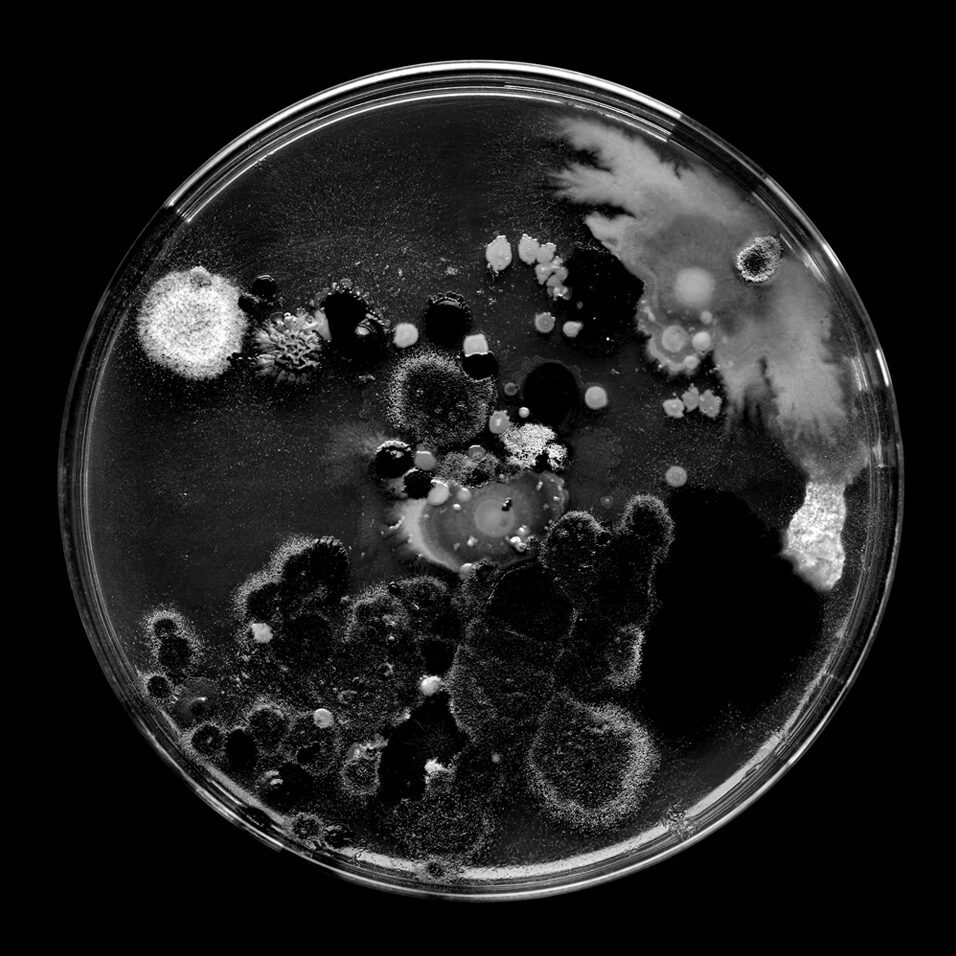 High contrast black and white image of a petri dish with clear indication of cellular growth